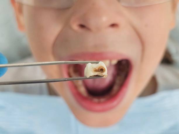 Best Emergency Dentist Near Me  in Day Valley, CA